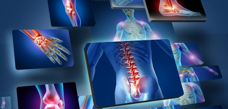 Rheumatology Rheumatology